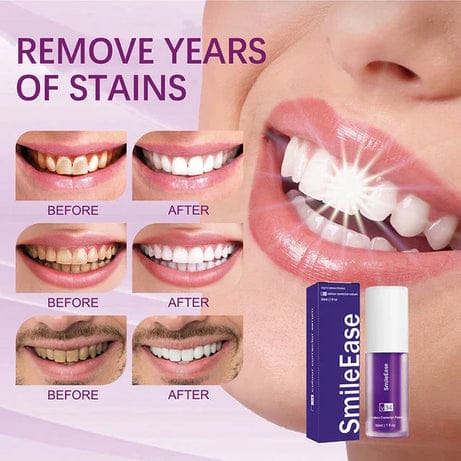 Hismile V34 Colour Corrector Serum – Instant Teeth Whitening | Purple Tooth Serum – 30mlHismile V34 Colour Corrector Serum – Instant Teeth Whitening | Purple Tooth Serum – 30ml